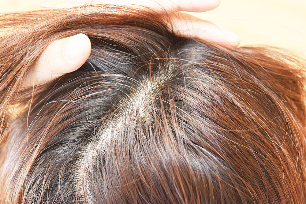 女性の頭皮が臭い原因・NGな習慣は？嫌なにおいを改善する方法を解説！